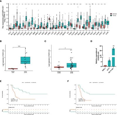 LncRNA FOXP4-AS1 Promotes Progression of Ewing Sarcoma and Is Associated With Immune Infiltrates